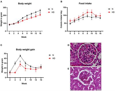 High-Fat Diet Increased Oxidative Stress and Mitochondrial Dysfunction Induced by Renal Ischemia-Reperfusion Injury in Rat